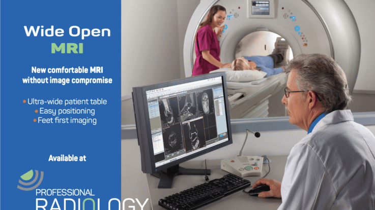 A New Age for MRI: How the Echelon Oval Fuses Precision Imaging with Optimal Patient Comfort