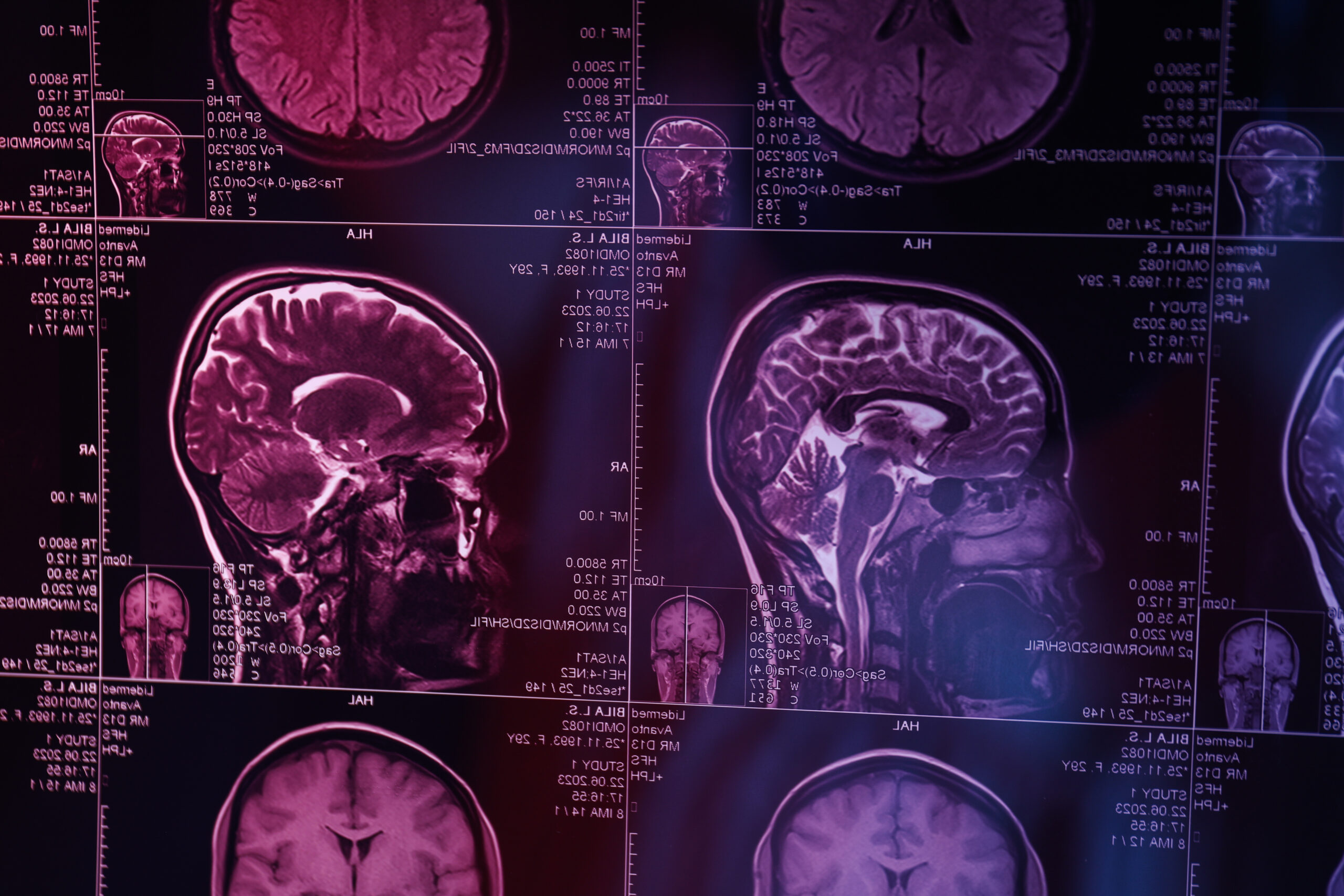 Beyond the Injury: How Imaging Can Reveal Underlying Health Issues You Weren’t Expecting
