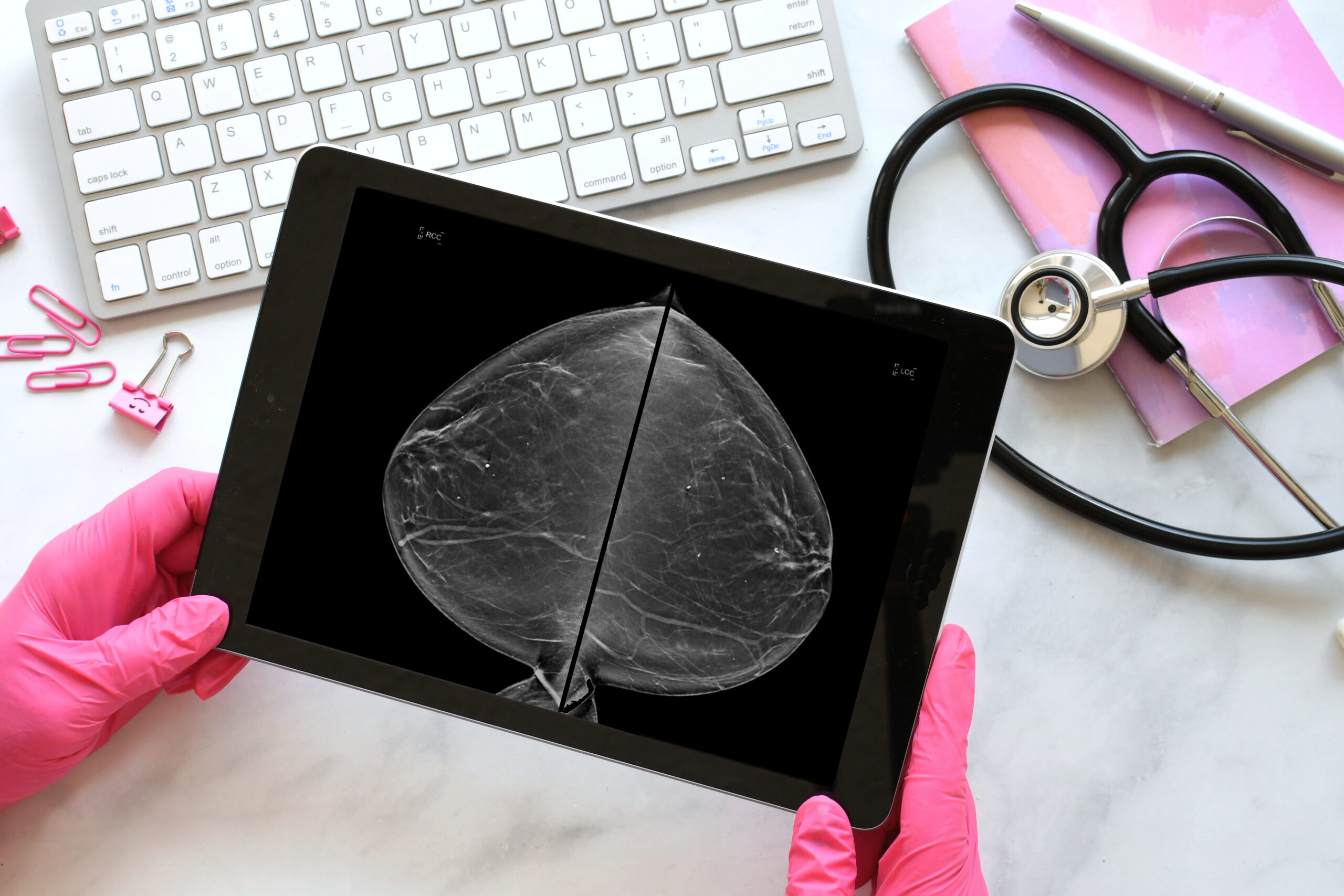 How Often Should You Get a Mammogram? Breast Cancer Screening Guidelines