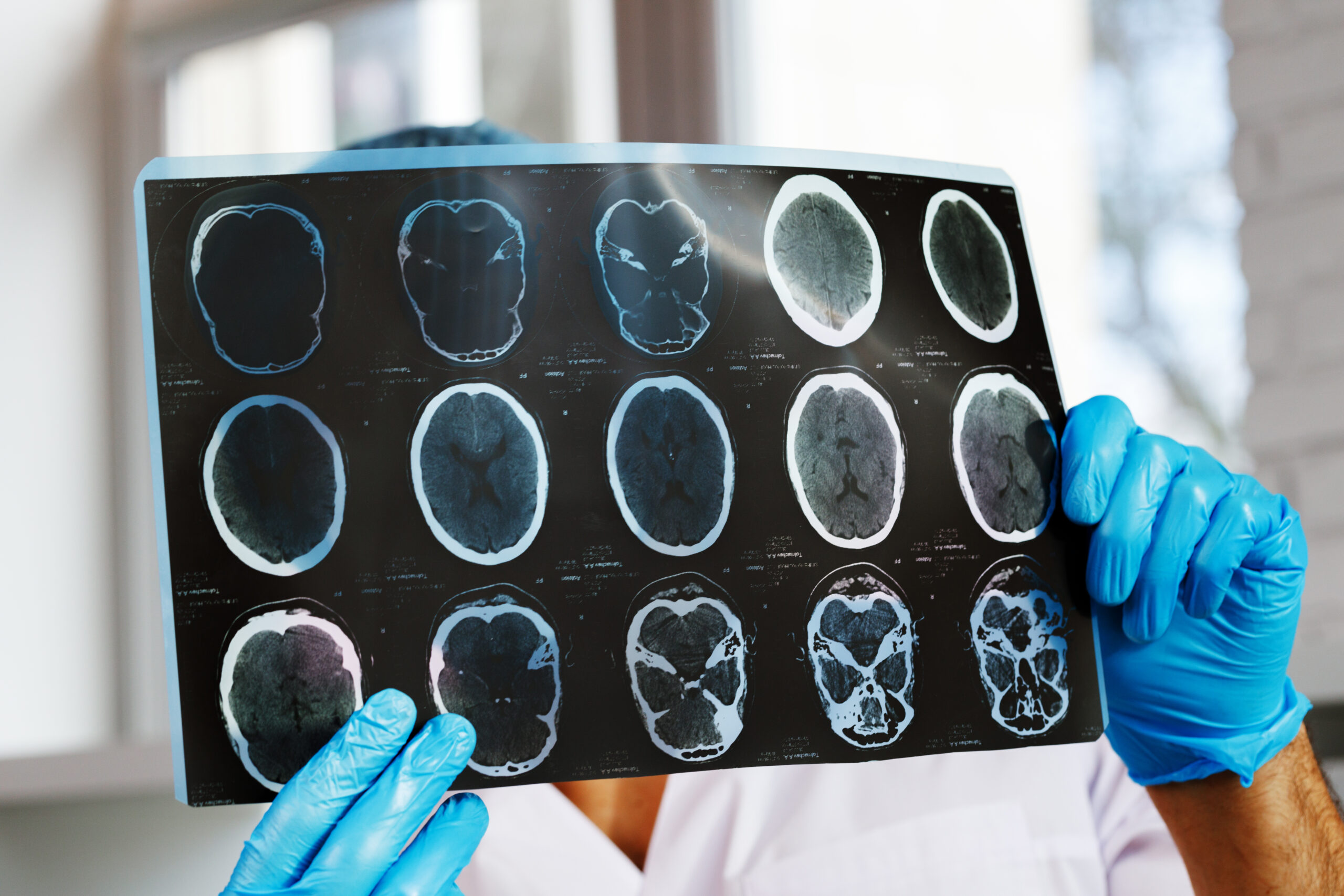 CT Scan With Contrast vs. Without Contrast: What’s the Difference?